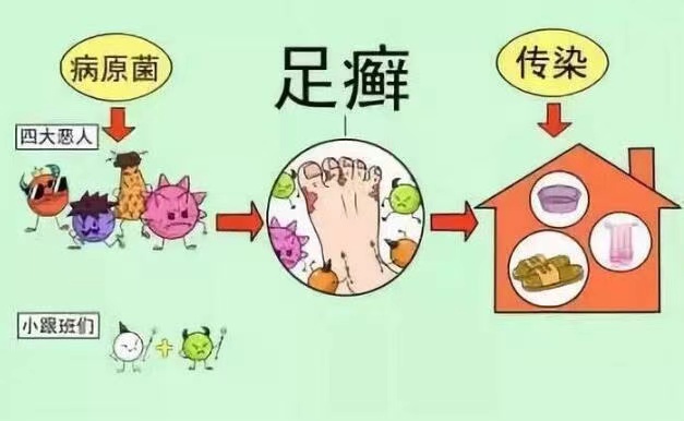 灰指甲外用藥膏 灰指甲外用藥膏
