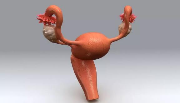 子宮肌瘤 