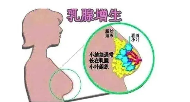 乳腺膏加工廠家