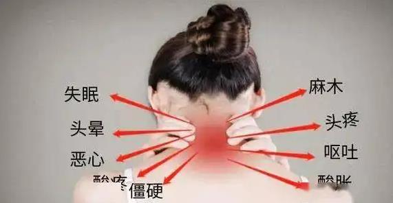 頸椎噴劑代加工廠家
