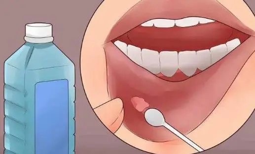 口腔噴劑代加工廠家