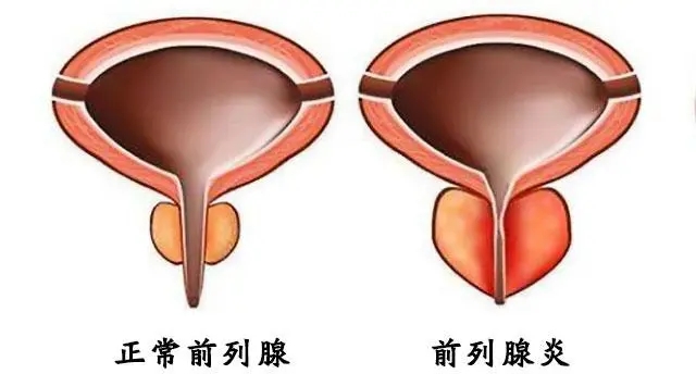 前列腺凝膠生產(chǎn)廠家