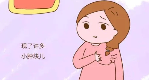乳腺膏貼牌廠家